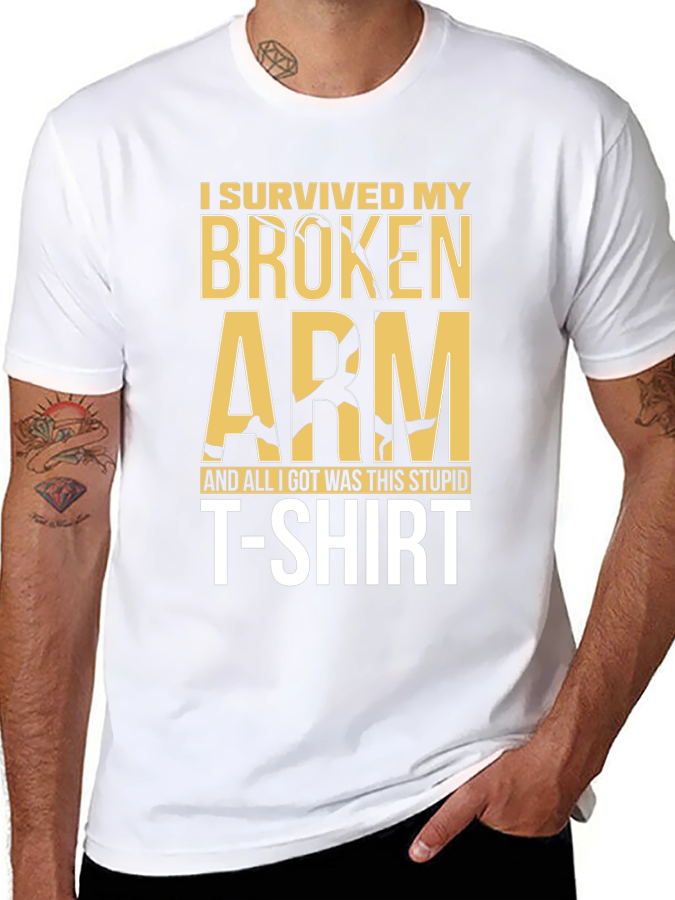 I Survived My Broken Arm T-Shirt
