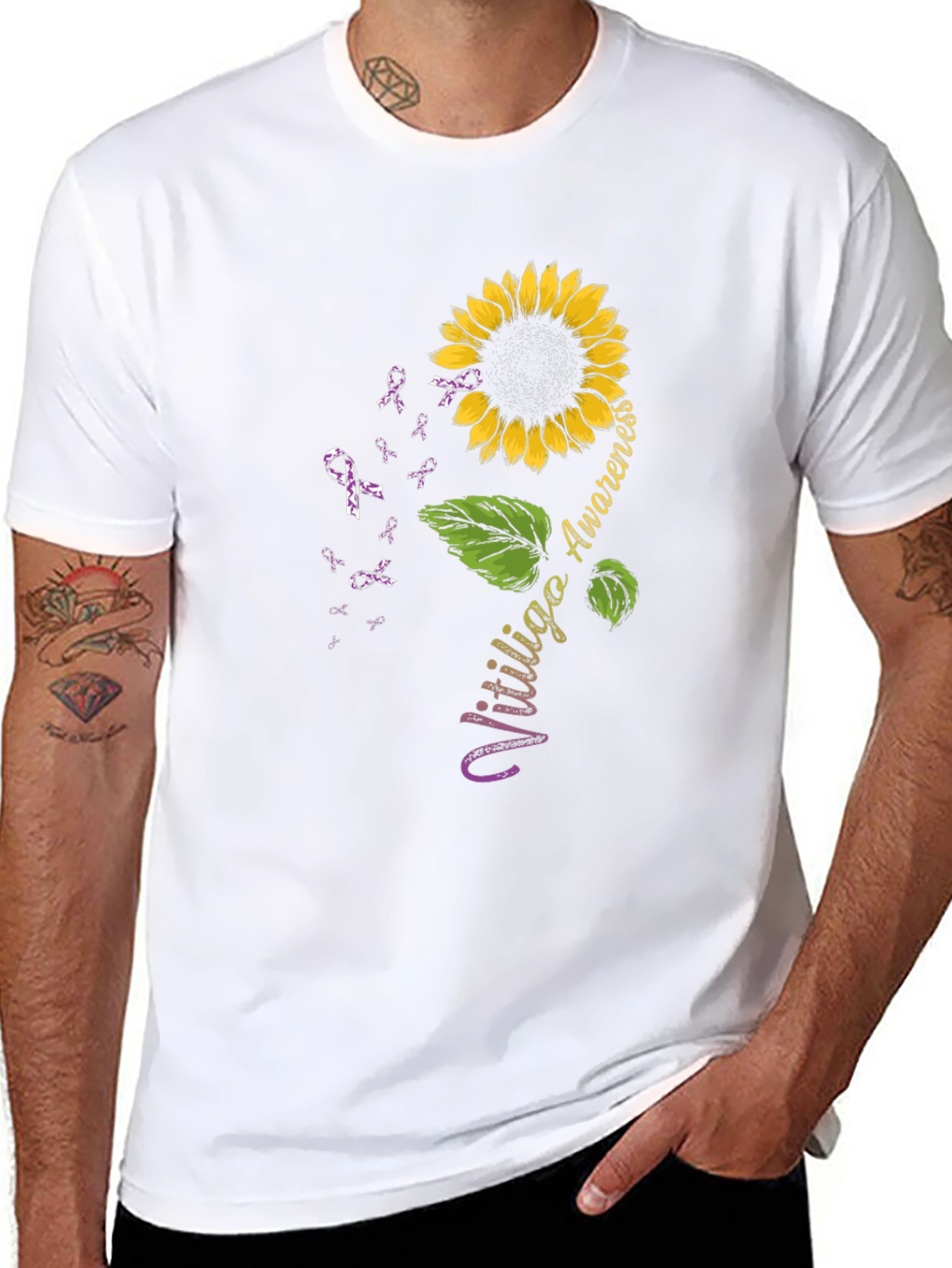 Vitiligo Awareness Sunflower T-Shirt